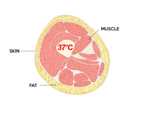 Weight Management